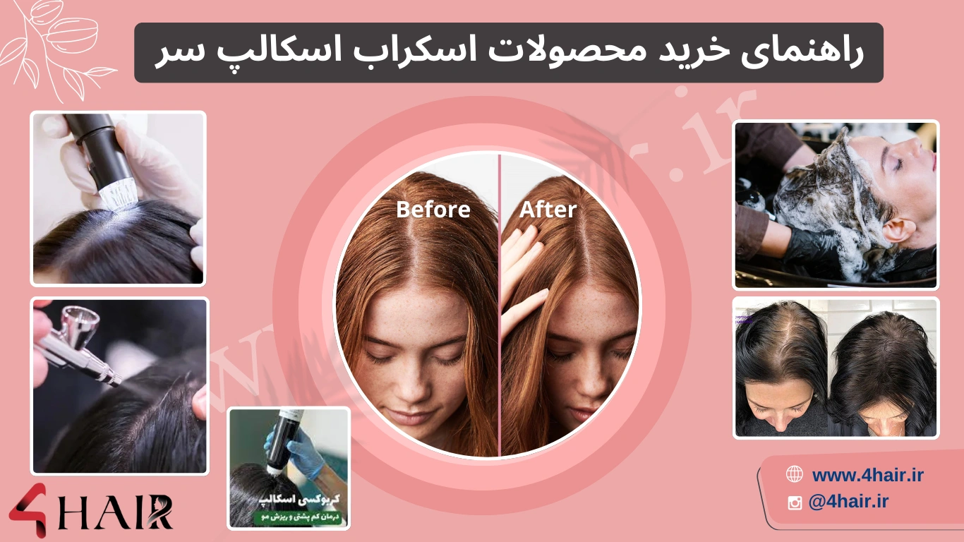 لاین اسکراب اسکالپ سر