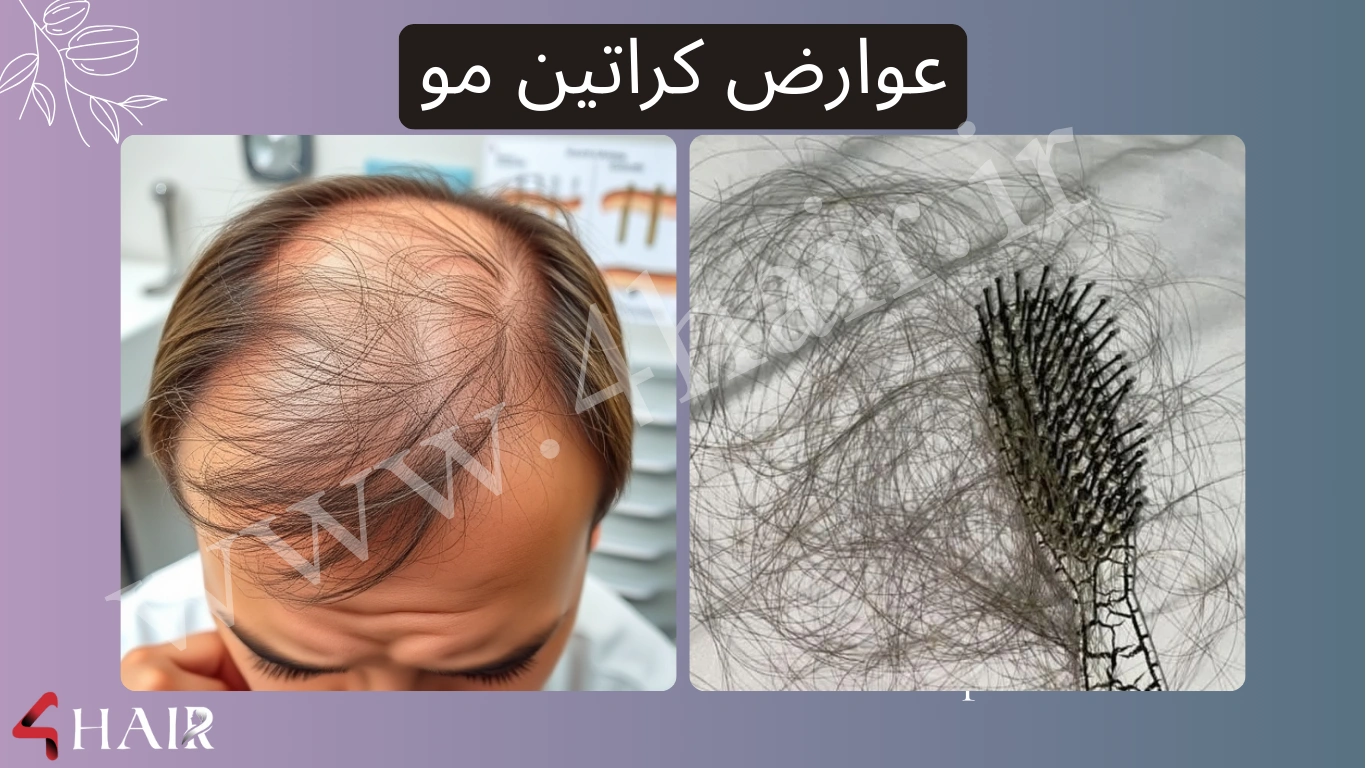 عوارض کراتین مو مردانه