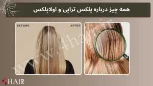 بلاگ