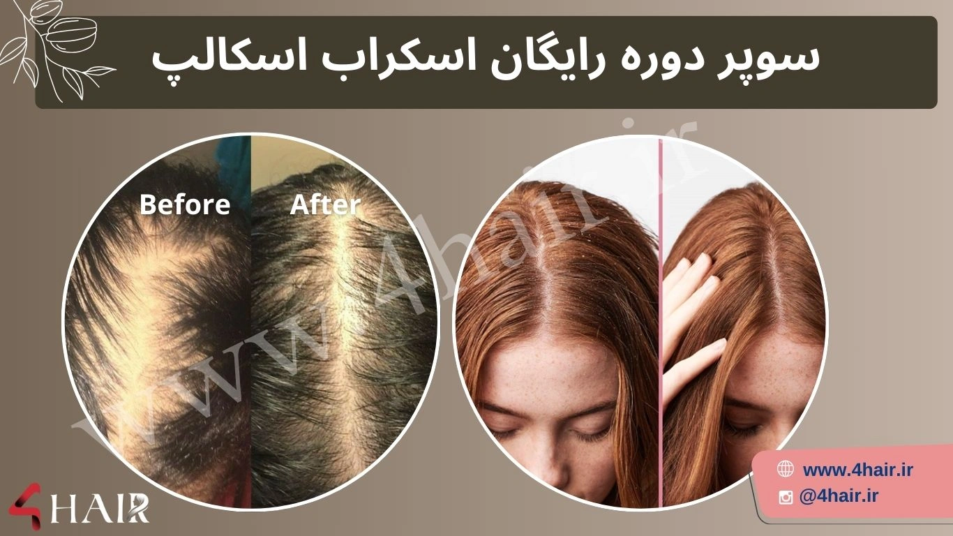 سوپر دوره رایگان آموزش اسکراب اسکالپ مو